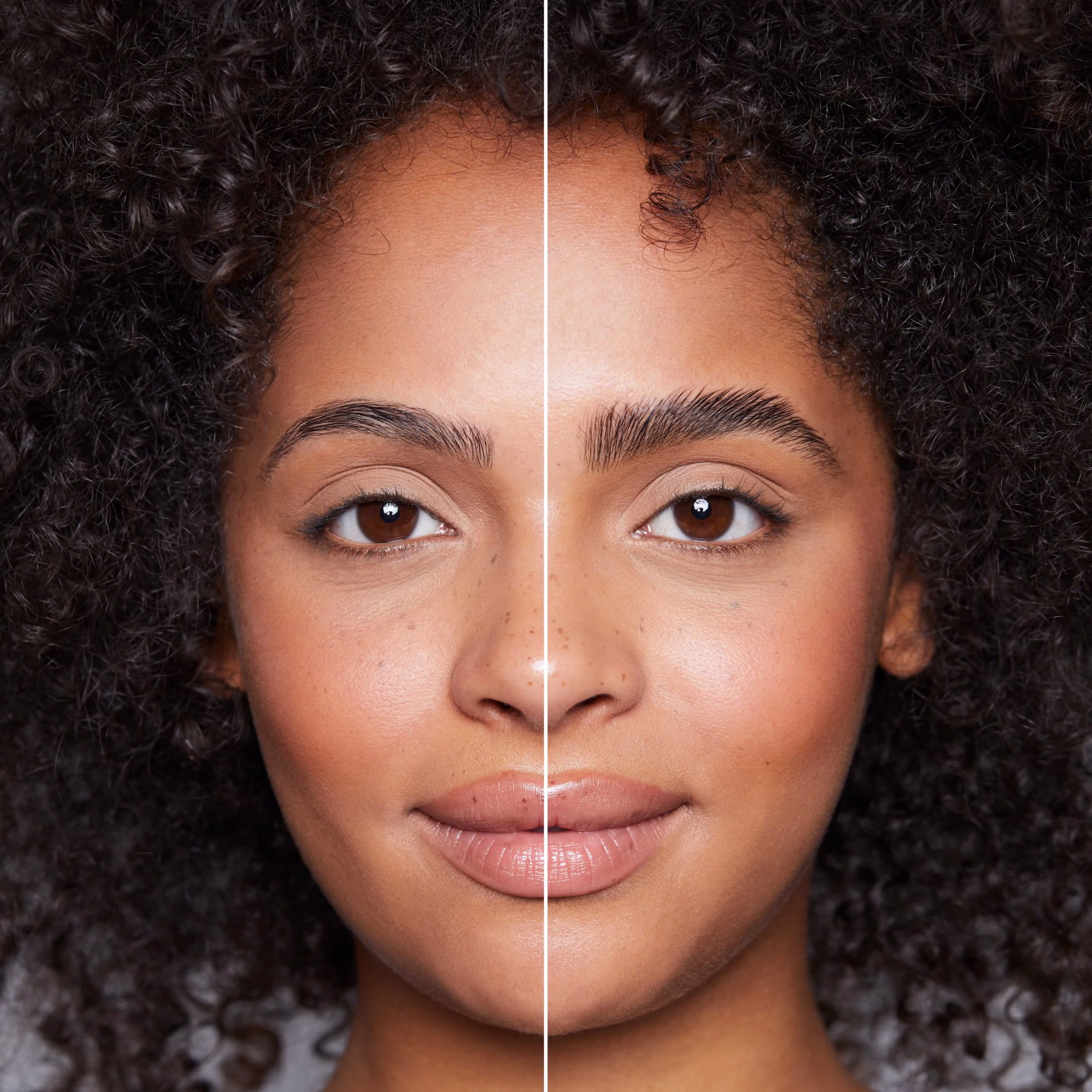 browlift
