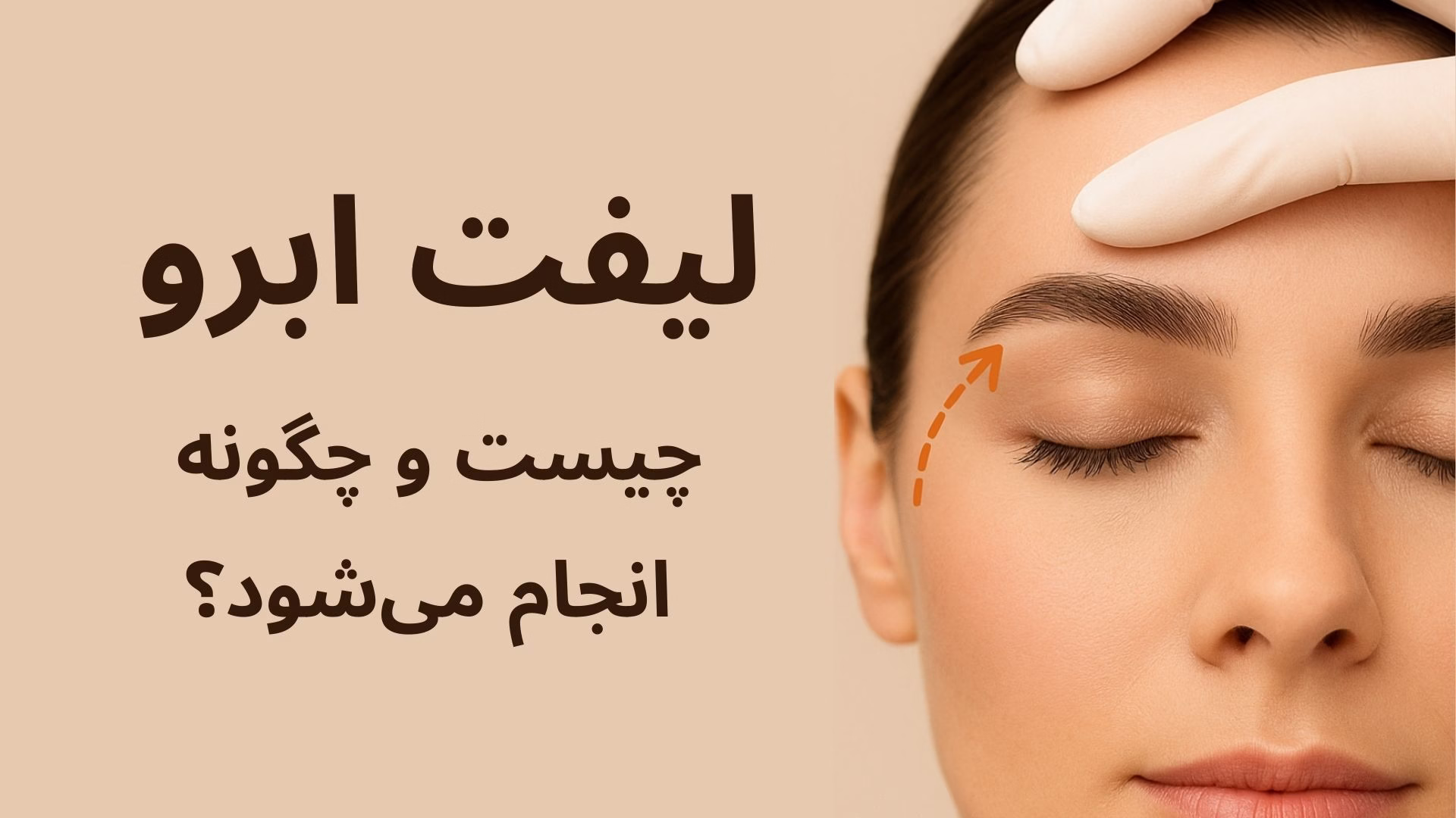 لیفت ابرو چیست و چگونه انجام میشود؟ | راهنمای کامل با مزایا و عوارض لیفت ابرو چیست و چگونه انجام می_شود؟
