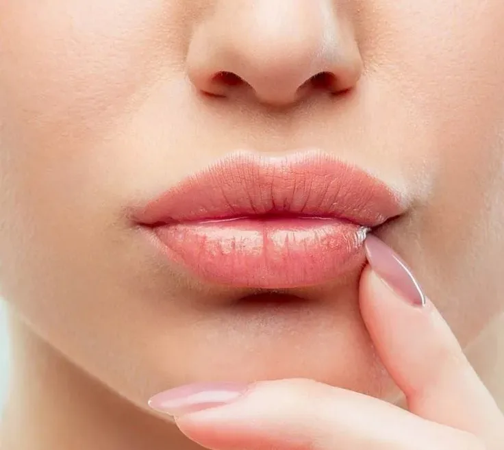 یاسی؛ ملایم ولی خاص