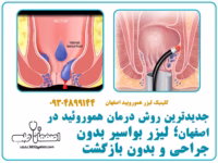 پرطرفدارترین عینک طبی زنانه جدیدترین روش درمان هموروئید در اصفهان